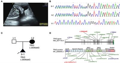 Case report: Phenotype expansion and analysis of TRIO and CNKSR2 variations